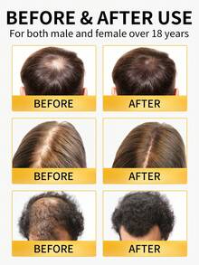 生姜头皮按摩油，生姜护发精油，天然滋养头皮油，蕴含生姜和迷迭香，情人节和母亲节的完美礼物，男女皆宜 - 薑 - 查看 2