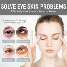Eye Circles Dark Circles Eye Bags Removal Lifting Firming Smoothing And Removing Fat Particles Skincare Tools UGJG - 1 - 查看 4