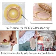 ¡RecomendadoMediss Anillo De Barrera Cutánea Para Ostomía (2 Piezas) Cubierta Para Bolsa De Colostomía, Cinta Precortada Para El Cuidado Del Sistema De Estoma De Ileostomía, Diámetro Exterior De 4", 5 Unidades¡Top de Temporada - 1 - Ver 8
