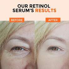 视黄醇精华液，柔滑面部精油，针对黑斑、老年斑和细纹，玻尿酸敏感肌护理面部精华 - Retinol - 查看 3