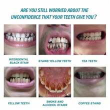 Teeth Cleaning, Stain Removal, Oral Hygiene Care, Environment Care Toothpaste - 1 - View 3