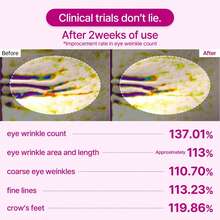 钙质丰盈眼膜 – 紧致水凝胶眼膜，有效缓解眼袋和细纹，深层补水，60片装 - 眼膜 - 查看 12