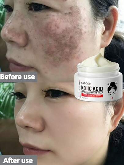 SADOER Cuidado de la piel con ácido kójico para blanquear y eliminar manchas, ilumina, afina los poros, crema facial/crema para los ojos, cuidado facial - Fórmula suave y no irritante, apta para todo tipo de piel, crema facial hidratante para hombres y mujeres