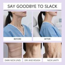 20片装Viareline颈部紧致提拉贴 - 紧致肌肤，减少双下巴，透明舒适，塑造年轻光滑的颈部轮廓 - 頸部彈性貼 - 查看 3