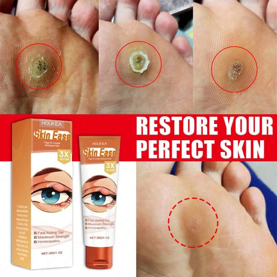 Smooth And Flawless Skin, Not Troubled By Skin Problems - 1 - View 1