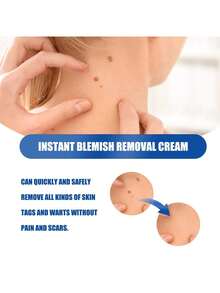 Carefully Regulate Skin Bumps And Restore The Skin's Original Beauty - 1 - View 2