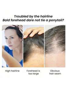 Reduce Loss Scalp Treatment More Thicker Keep Regrowth Oil Control Hair Nourish Essencial Oi - 1 Item - View 4