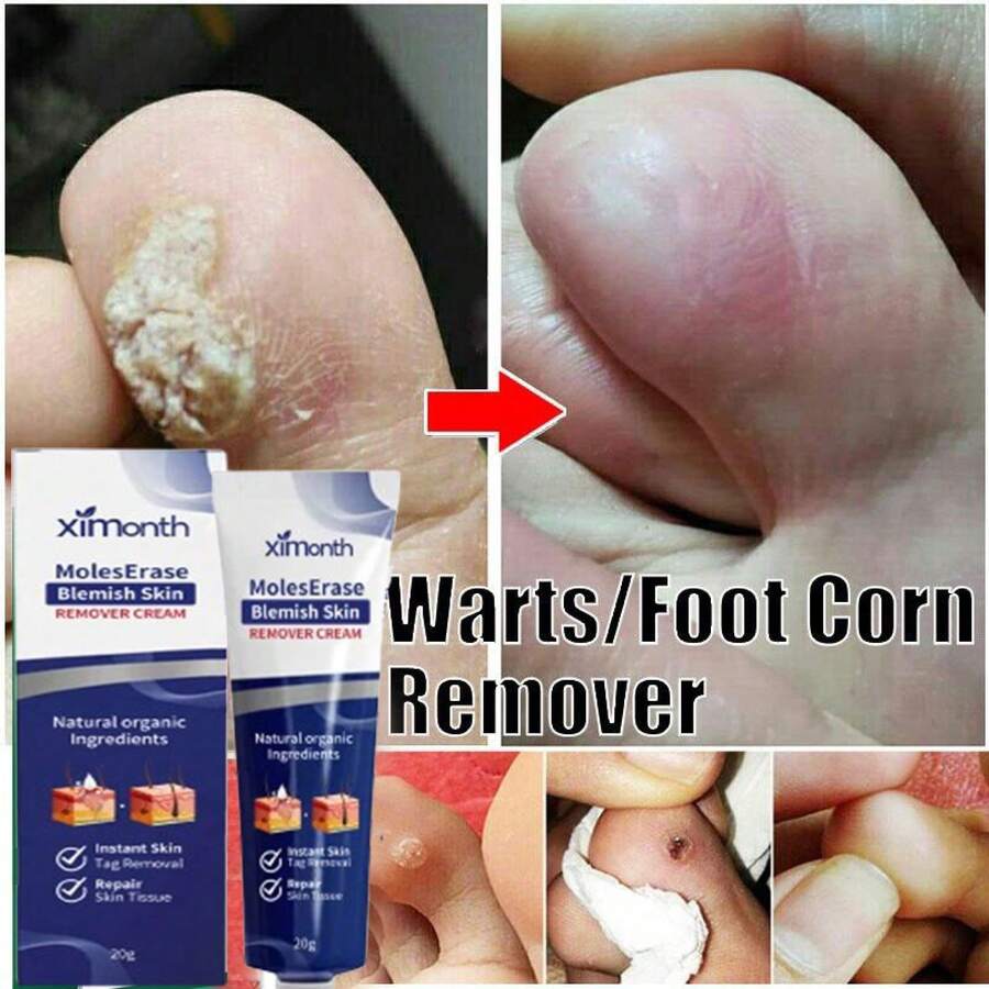 Gentle Cleansing Of The Body, Delicate And Smooth Skin Care, Perfect Skin - 1件 - 查看 1