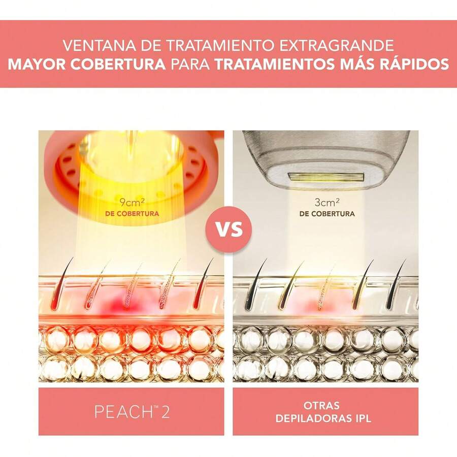 ¡RecomendadoFOREO PEACH 2 – Depiladora IPL luz pulsada ultrarrápida – Uso corporal y facial mujer y hombre – Máquina depilación láser en casa – Enfriamiento avanzado – Protector silicona – Peach¡Top de Temporada - Como - Ver 1