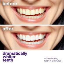Teeth Cleaning, Stain Removal, Oral Hygiene Care, Environment Care Toothpaste - 1 - View 5