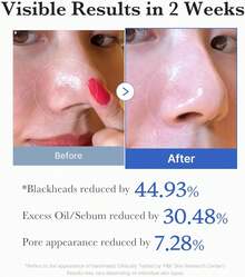 [ MEDICUBE ] ZERO PORE PAD 2.0 155g, 5.46oz (70 Pads) - Pore - View 5