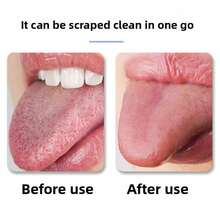 Stainless Steel Mini Portable Adult Tongue Scraper, Home Tongue Cleaning Tool To Remove Bad Breath - Multicolor - View 7