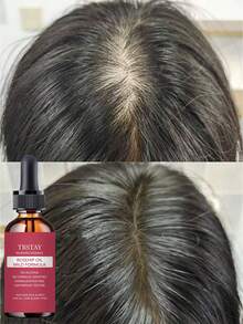 TRSTAY 10 In 1 Hair Care Serum & Hair Oil - Enriched With Multiple Hair-Nourishing Botanical Extracts, Gentle Formula, Helps Sparse Hair Look Fuller And Thicker. - 彩色 - 查看 6