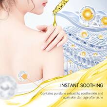 Acne-Prone Skin Care Set: Suitable For Acne-Prone Skin, Providing Gentle Hydration And Moisturizing. - 痘肌保養套裝 - 查看 5