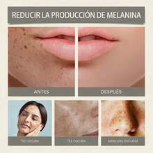 Hoygi Suero Facial de Vitamina C - Ilumina la Piel y Reduce Manchas, Hidratación Intensiva, Antioxidante Potente, Rejuvenece y Mejora la Elasticidad, Reduce los Poros y las Marcas de Acné, Ideal para Todo Tipo de Piel, 30ML - Suero de ácido hialurónico - Ver 5