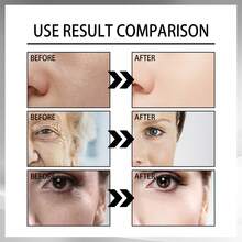 Snail Essence Face Cream: Gentle, Nourishing, Hydrating, And Firming Facial Skin Moisturizing Essence. - Snail Essence Face Cream - View 7