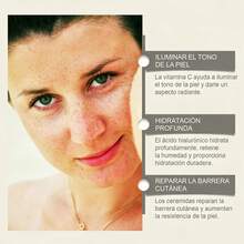 Hoygi Suero Facial de Vitamina C - Ilumina la Piel y Reduce Manchas, Hidratación Intensiva, Antioxidante Potente, Rejuvenece y Mejora la Elasticidad, Reduce los Poros y las Marcas de Acné, Ideal para Todo Tipo de Piel, 30ML - Suero de ácido hialurónico - Ver 7