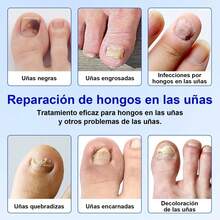 Nail Strengtheners & Repair - 21pcs - View 9