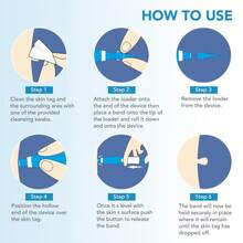 Herramienta para eliminar verrugas, lunares y callos, caja azul - Azul - Ver 11