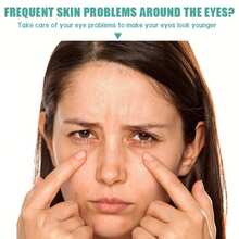 1 Pair Hyaluronic Acid Micro-Needle Eye Mask Patches, Containing Retinol And Peptides, Suitable For Eyes, Face And Nose, Provides Deep Hydration, Fades Spots And Brightens Complexion. Needle Length Less Than 0.25mm. Dissolving Micro-Needle Hyaluronic Acid Eye Patches - Multicolor - View 4