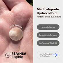 AVARELLE Acne Cover Patches, Eligible Hydrocolloid Pimple Patches For Face With Tea Tree Oil, Korean Skincare Zit Patches For Face | HSA Store Eligible Items | Vegan, Cruelty-Free - MàuB - Xem 2