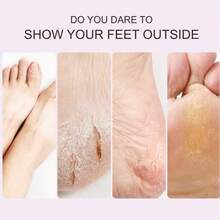 mingxuan 4对装，高效足膜，可连续使用4次，滋润足部肌肤，令肌肤自然光滑透亮；手膜，手足两用膜，针对足部厚茧，滋润手部肌肤；强效水杨酸手足膜 - 手足膜去角質 - 查看 5