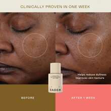 EADEM Gentle Exfoliating AHA &Amp; PHA Toner, Milky Rice Toner Exfoliant With Lactic, Azelaic, &Amp; Tranexamic Acid, Rice Water AHA Exfoliator &Amp; Pore Minimizer For Face And Body, 50 Oz, Cashmere Peel - Trắng - Xem 3