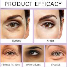 微针眼膜，蕴含胶原蛋白，深层补水，抚平细纹，减少眼袋 - 微針眼膜 - 查看 8