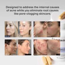 CLEARSTEM - MINDBODYSKIN Hormonal Acne Supplement (5-HTP) - Natural DIM Supplement - Skin Care Vitamins - Hormone Balance, Antioxidants - Gluten Free, Cruelty Free - 30 Servings, 90 Capsules Weight Loss Free Shipping Wellness Vitamins Supplements Chlorophyll Creatina Monohidratada Vitamins Probiotics For Women Protein Powder Quick Ship Items  Creatina Colageno - 90 viên nang - Xem 8