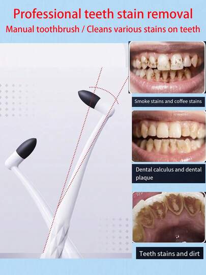 أداة إزالة بقع الأسنان اليدوية، فرشاة أسنان، كاشطة الجير، أدوات تبييض الأسنان، فرشاة تنظيف بقع الأسنان، منظف تلميع وتبييض الأسنان الاحترافي، جهاز تنظيف الأسنان اليدوي، مزيل بقع الأسنان، ممحاة جير الأسنان، فرشاة تنظيف بقع الأسنان، أداة تنظيف الأسنان الكاشطة الدقيقة لإزالة بقع الأسنان والقطران والشاي والتكلس، قابلة لإعادة الاستخدام والغسيل بالماء