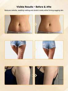 Massaggiatore linfatico GDQ e strumento per massaggio anticellulite, macchina per il modellamento del corpo, aiuta a ridurre smagliature e cellulite, dispositivi per sollievo dal dolore per sciatica, braccia, fianchi, gambe, muscoli (bianco) - Bianco - Visualizzare 9