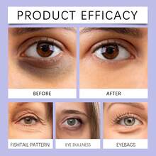 20克蜂蜜胶原蛋白眼霜 - 内置按摩器，保湿紧致，消除浮肿，打造光滑年轻的双眸 - 蜂毒眼霜 - 查看 3