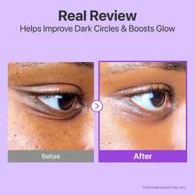 numbuzin No.9 NAD+ Retinol Volumetox Eye Cream 10ml - Retinol - View 8