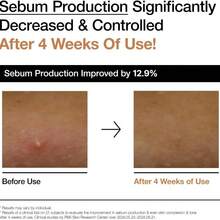 Anua Rice 70 Glow Milky Toner 250ml, Bestseller Korean Skincare, Glass Skin, Hydrating Barrier Care, Rice Water, Niacinamide, Ceramides, All Skin Types, Fragrance-Free, Non Comedogenic, Korean Skincare, Best Korean Skincare, Top Selling Toner, Kbeauty, K-Beauty, Toner For Dry Skin, Dull Skin, Best Toner For Combination Skin, Balance Excess Sebum, Fragrance-Free Toner, Summer, Y2k, Swimwear, Good For Acne Skin, Reduce Dark Spot, For Acne Prone Skin, Gift For Mom - Rice+Ceramide - 查看 3