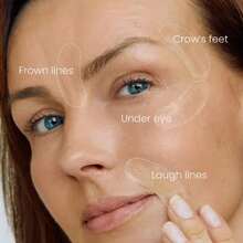 3对蓝色微针眼膜，紧致眼周肌肤，温和不刺激，缓解眼部疲劳，按摩眼罩套装，温和不刺激，缓解眼部疲劳 - 彩色 - 查看 2