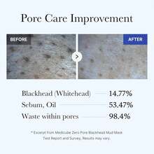 Medicube Zero Pore Blackhead Mud Facial Mask 100g, Bestseller Korean Skincare, Bestseller Facial Mask, Pore Tightening, Quick Mask, Quick Dry Mask, AHA, BHA, PHA, Acne, Blemish, Uneven Texture, Pore Purifying Clay, Korean Mask, Boyfriend Husband Father Brother Girlfriend Wife Mother Friend Birthday Gift, Summer, Bikini, Y2k, Dermatologist-Tested, Best Korean Skincare, Kbeauty, K-Beauty, Best Selling Korean Mask, Must Have Korean Skincare, Swimwear - AHA/BHA/PHA - 查看 3