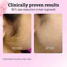 C2ZU Caramela Beauty Cyperus Rotundus Oil For Natural Permanent Hair Reduction - 1 - Xem 3
