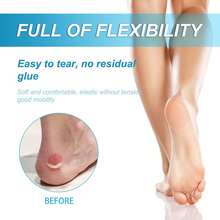 Full-Body Anti-Friction Stick - Waterproof, Sweat-Proof, Easy-To-Apply Anti-Friction Cream Stick, Preventing Abrasions On Thighs, Heels And Forearms. - Anti-friction Rod - View 6