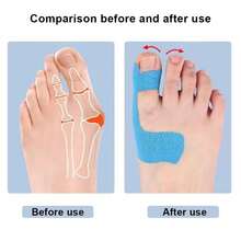 8pcs Elastic Bandage Toe Separator, Breathable Toe Divider, Self-Adhesive , Suitable For Men And Women Hallux Valgus Correction, Toe Separator - Multicolor - View 3