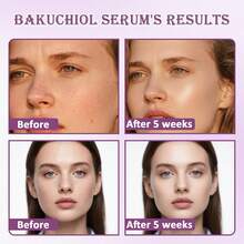 正品菊花视黄醇精华液——天然视黄醇替代品，适合敏感肌肤。日夜面部精华液可紧致肌肤，减少细纹。 - Collagen - 查看 5