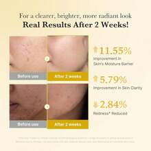 Medicube Kojic Acid Turmeric Niacinamide Serum 30ml - Hyaluronic Acid - View 6