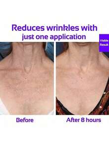 2pcs Neck Wrinkle Patches, Reusable Silicone Pads, Medical Grade, Suitable For Side Sleepers Night Care - Multicolor - View 10