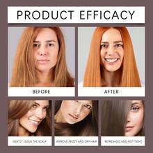 2-Pack Anti-Hair Loss Shampoo With Biotin Rosemary Onion Extract, Strengthens Hair, Reduces Breakage & Boosts Volume, For All Hair Types, 100ml Each - 2PCS - 查看 7