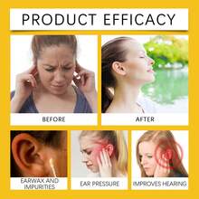 Set de velas para los oídos, limpieza y nutrición suave y cómoda de doble oído con velas de cera de abeja y miel - Ver 6