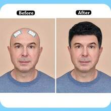 5-20片装蕾丝前假发胶带，双面防水蕾丝假发胶带，适用于假发、发片和接发 - 查看 8