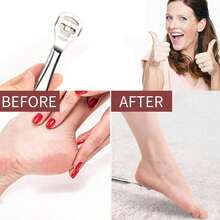 Professional Stainless Steel Foot Grater, Suitable For Calluses - Includes 10 Replacement Blades - Foot Care Callus Remover Pedicure Set - Silver - View 4