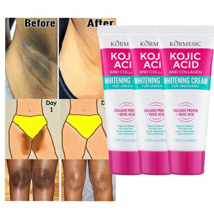 3pcs Skin Bleaching Cream For Women - Intimate Skin Care Lightening Cream For Intimate Areas, Private Parts, Underarms, Knees, Elbows, Inner Thighs, Bikini Areas–Dark Spot Remover For Face - Hyaluronic Acid - 查看 1