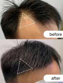 The Sideburn And Hairline Lace Hair Patches, Specially Designed For Men, Are Hand-Woven From 100% Real Human Hair, Offering A Natural Texture And Easy Maintenance. The Lace Base Is Lightweight, Breathable, And Completely Invisible, Precisely Filling In Gaps At The Sideburns And Hairline For A Fuller, More Dimensional Hairstyle. The Double-Piece Set Provides Better Value For Money, Allowing You To Effortlessly Create A Naturally Handsome Look. - Natural Black - View 8