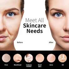 Silicone Face Scrubber, NågraCoola CLIE 2.0 Facial Cleansing Brush, Rechargeable, Waterproof Face Scrub Brush For Cleansing, Exfoliating, Massaging, Electric Facial Exfoliator For Women & Men - Black - Charcoal - View 4