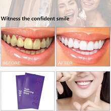 Stain Removing Teeth Whitening Strips, Purple Gentle Daily Whitening Strips For Surface Stain Reduction & Natural Shine, Portable For Home & Travel On-The-Go Use - Tím 8 - Xem 3